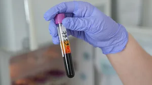 Жительница Алматы не смогла стать донором крови из-за препарата для похудения